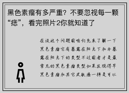黑色素瘤有多严重?不要忽视每一颗“痣”,看完照片2你就知道了